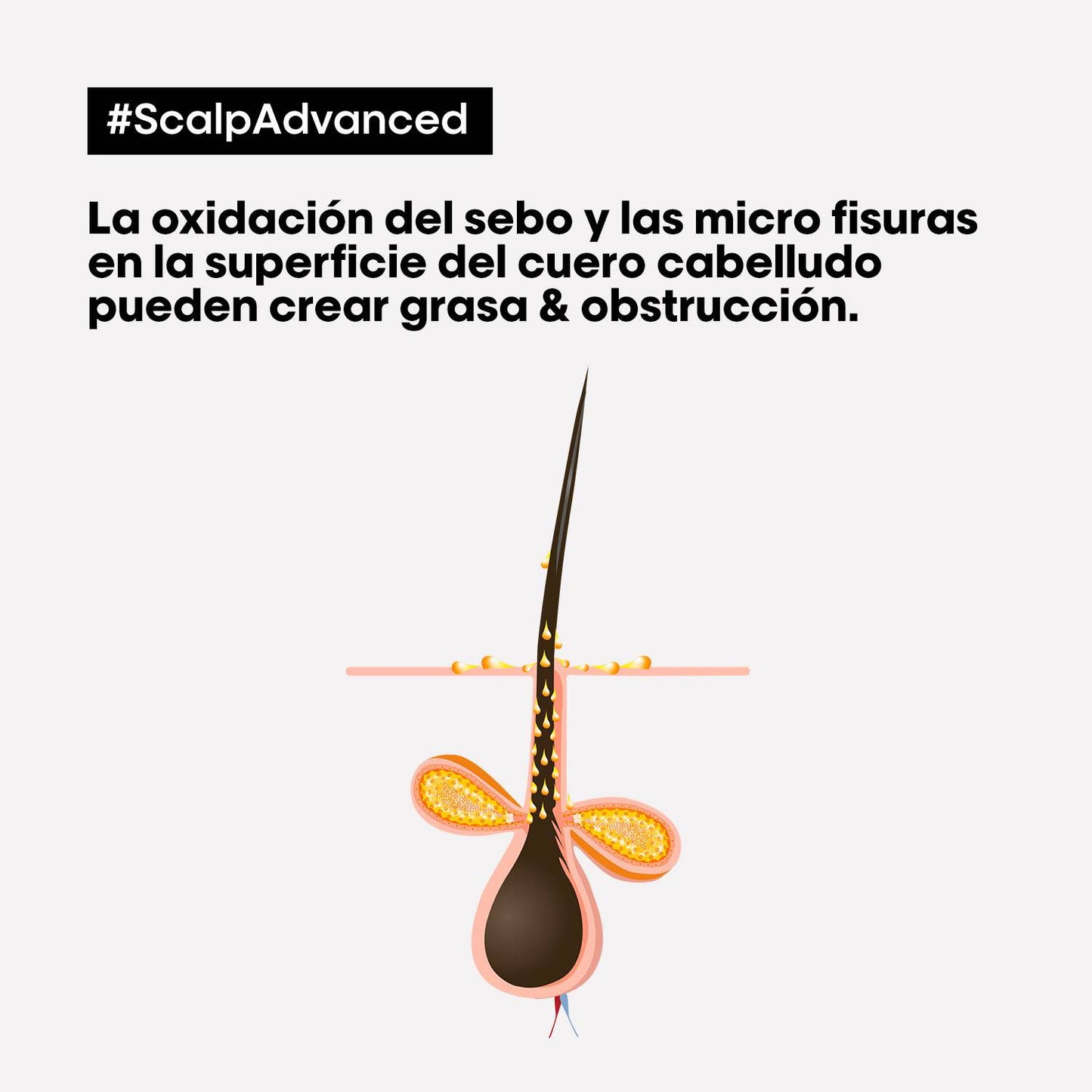 L’Oréal Professionnel Scalp Advanced | Shampoo Anti Grasa 300ml Limpieza Purificante y Control de Sebo