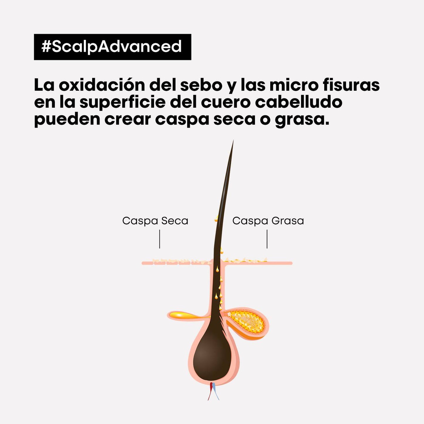 L’Oréal Professionnel Scalp Advanced | Shampoo Anticaspa 300ml Limpieza Purificante y Equilibrio del Cuero Cabelludo
